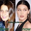 Bella-hadid-prima-dopo