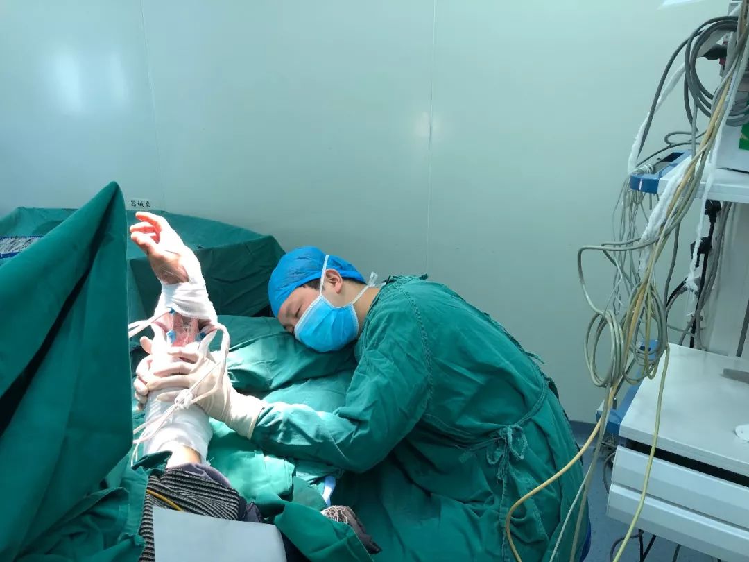 Cina, opera per 20 ore e alla fine si addormenta vicino al paziente, tenendogli il braccio per favorire la circolazione FOTO