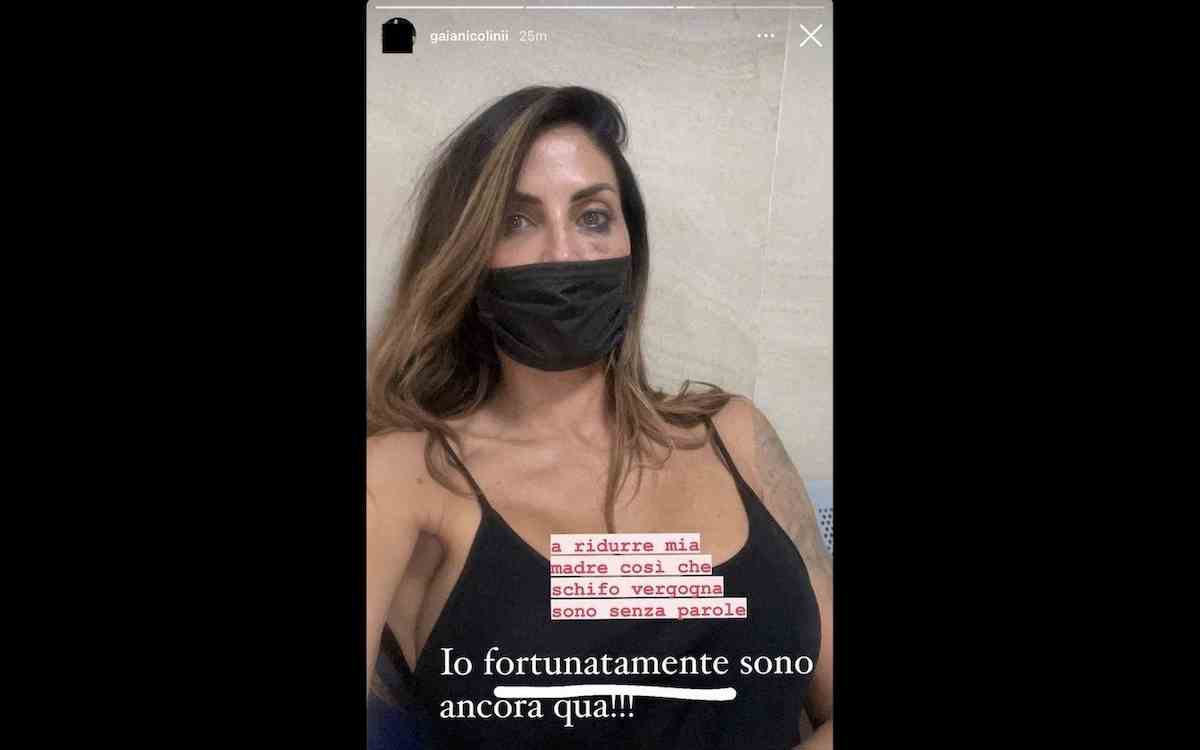 Guendalina Tavassi pubblica foto con occhio nero su Instagram e poi la cancella. La figlia: "Come l'hanno ridotta..."