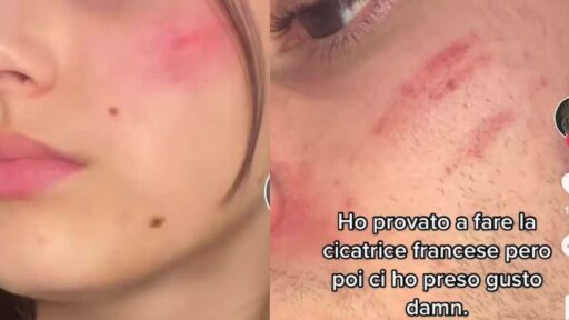 Cicatrice francese: l'ultima moda su TikTok è sfregiarsi il volto per sembrare duri