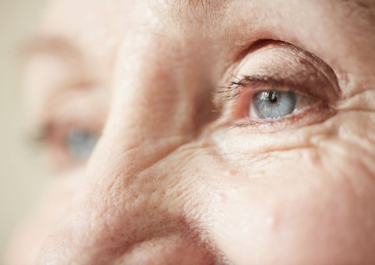 Alzheimer e demenza senile: dagli occhi i segnali d'allarme che mettono in guardia prima dei problemi di memoria