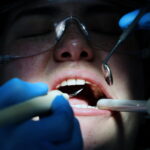 tumore dentista