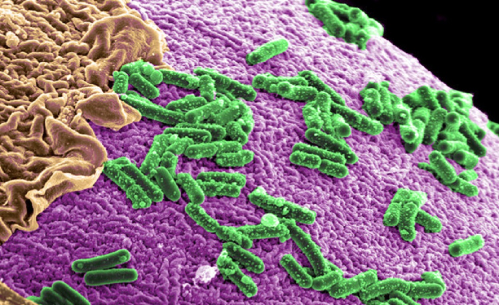 microbioma intestinale