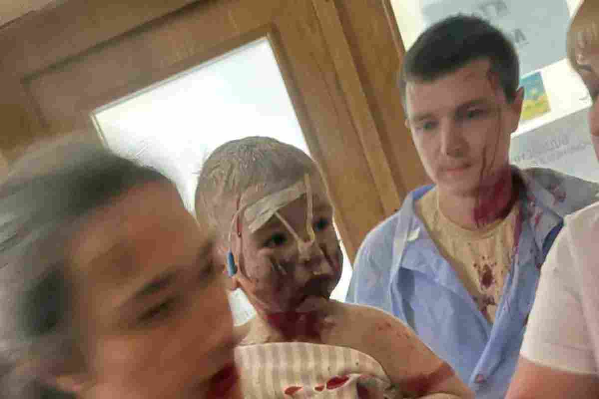 Lo sguardo del bambino ferito all'ospedale bombardato a Kiev
