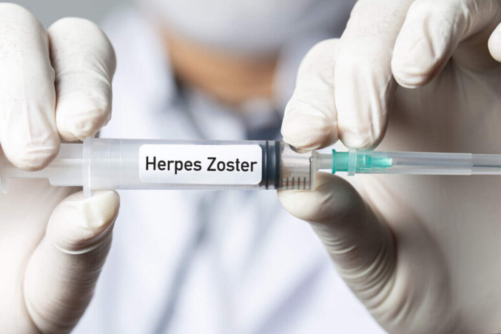 Vaccino Herpes Zoster