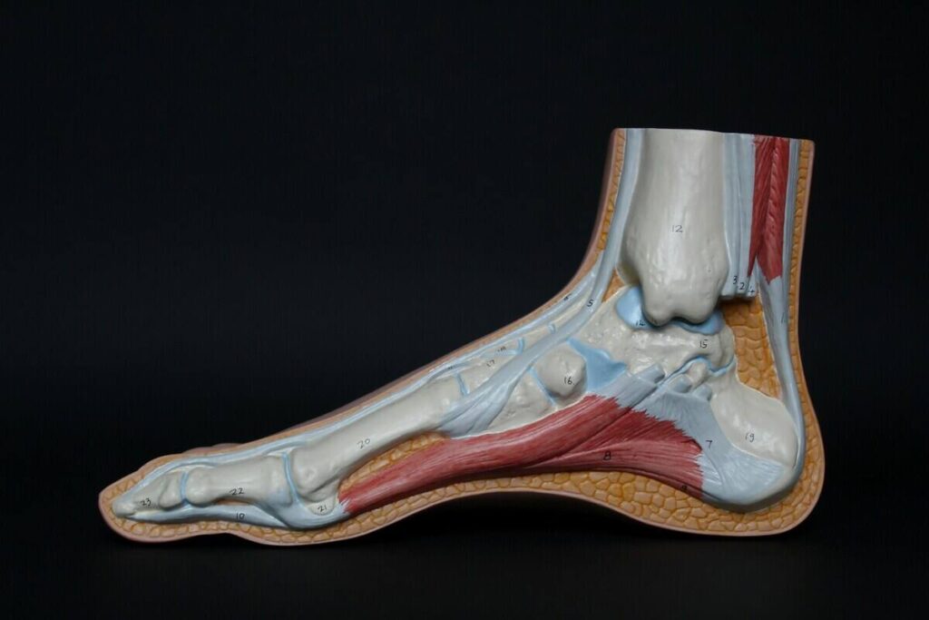 piede osteoartrite