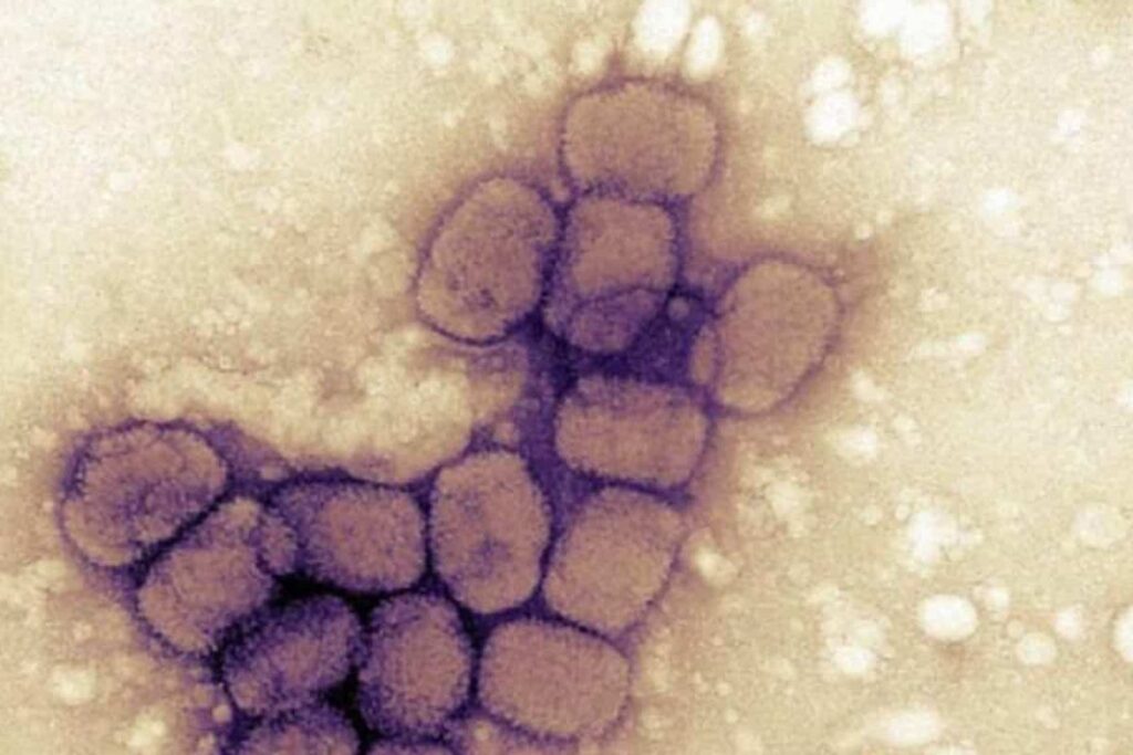 Il virus al microscopio