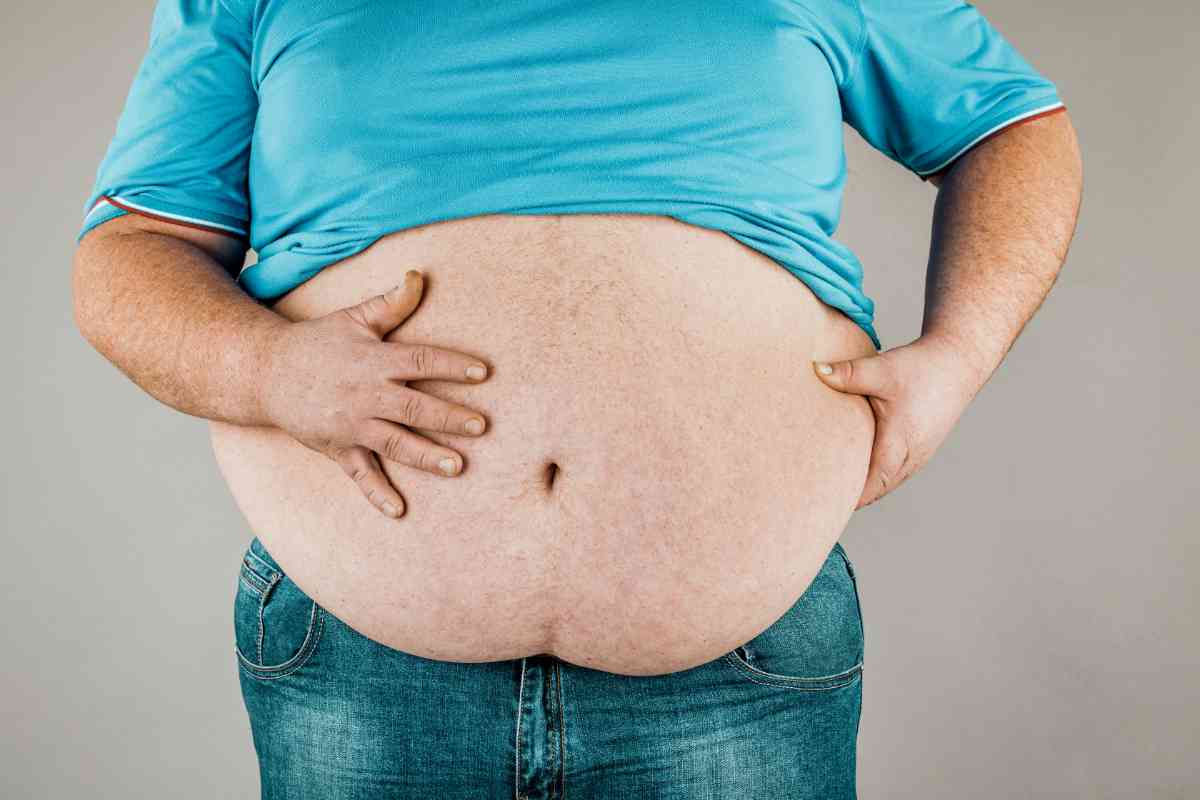 uomo obeso come simnolo della dieta del dottor Nowzaradan