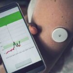 Donna con sensore di diabete sul braccio e app sullo smartphone