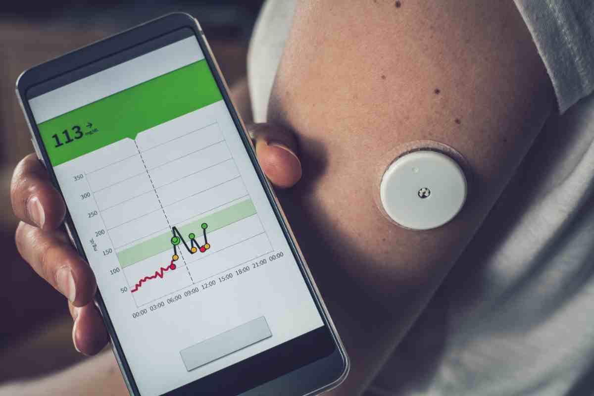 Donna con sensore di diabete sul braccio e app sullo smartphone