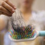 donna mostra i capelli caduti in una spazzola