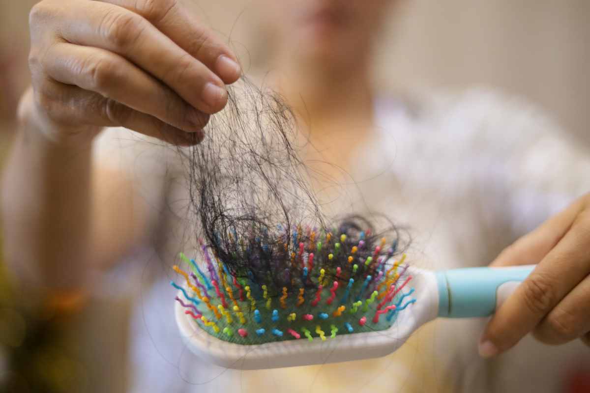 donna mostra i capelli caduti in una spazzola