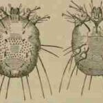 Acaro della scabbia