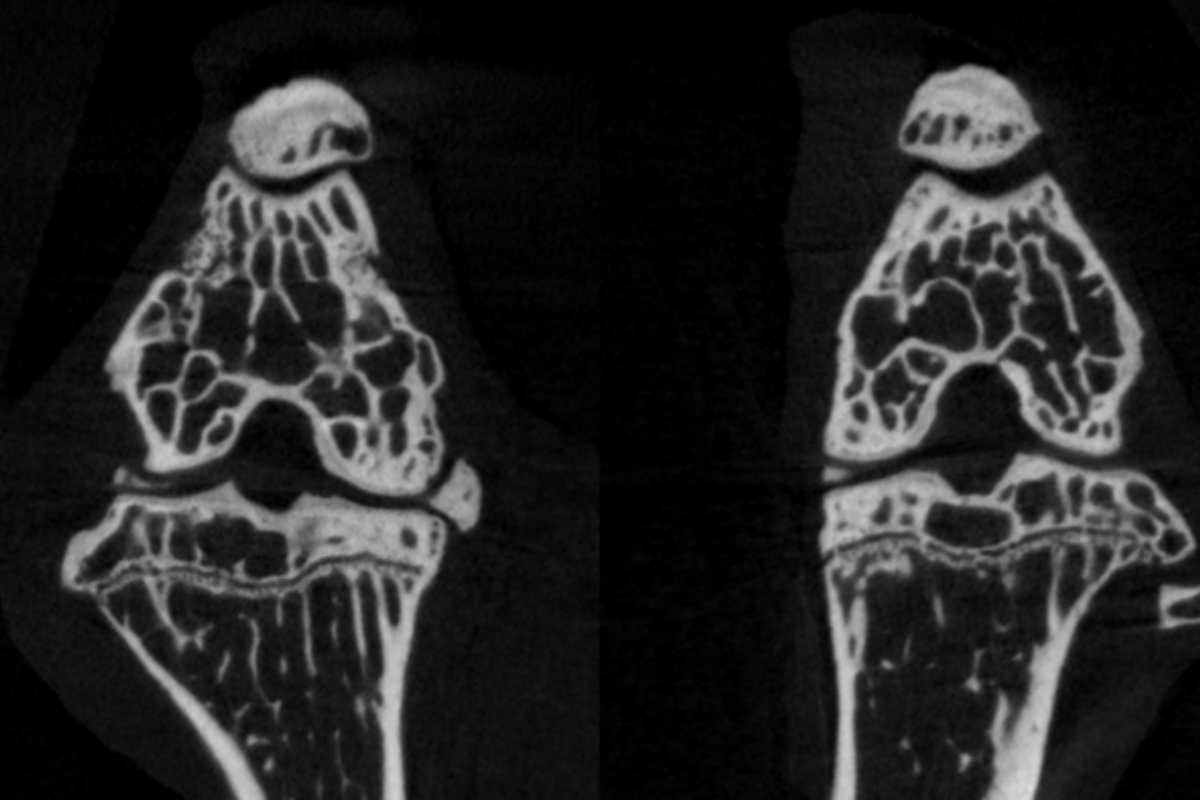 L'articolazione del ginocchio di un topo obeso con i segni dell'artrosi, e quella di un topo normopeso