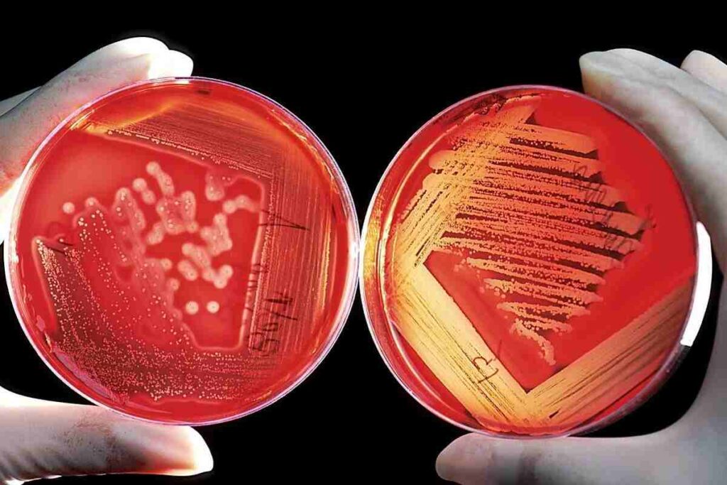 una colonia di batteri in un campione di ricerca