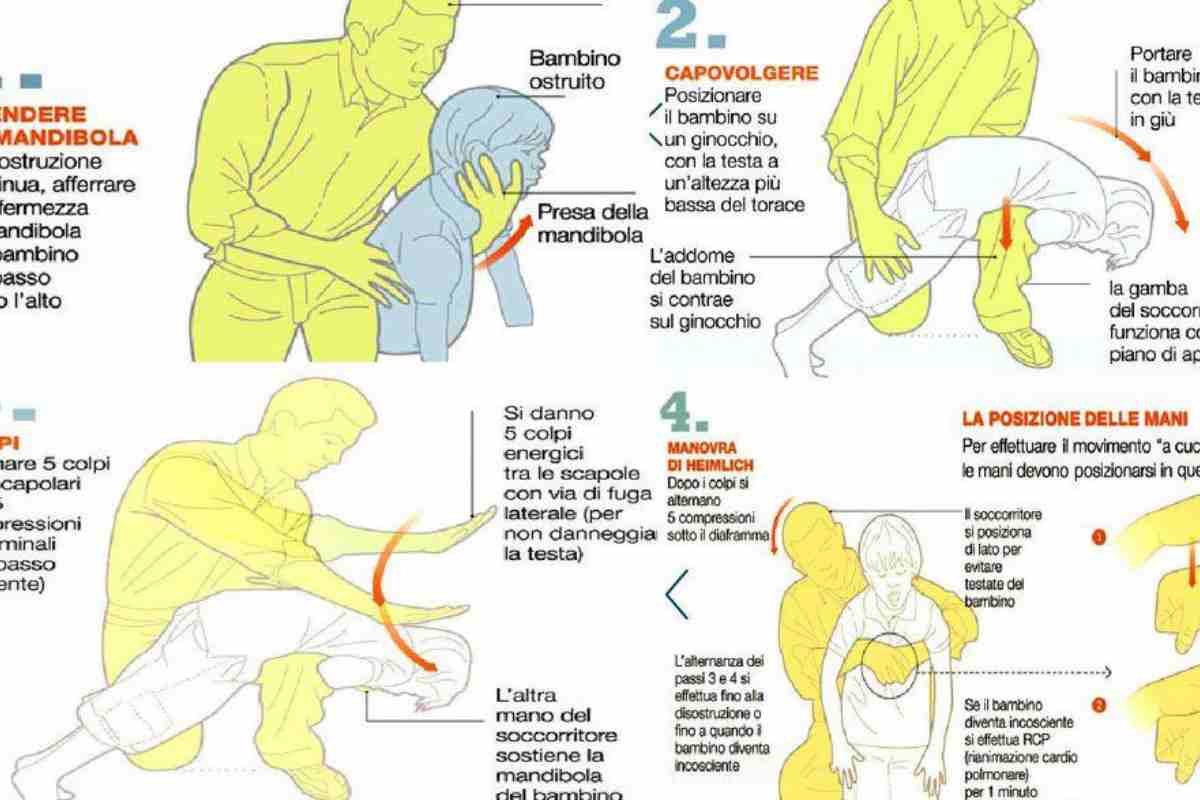 come fare la manovra di heimlich