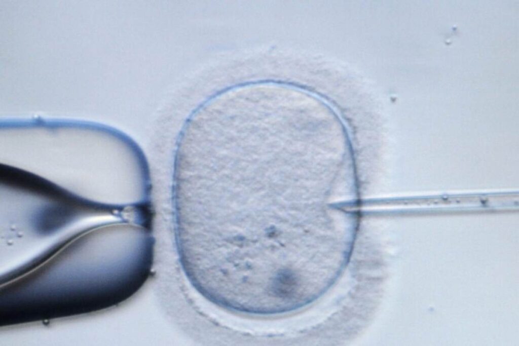 Rappresentazione della fecondazione in vitro