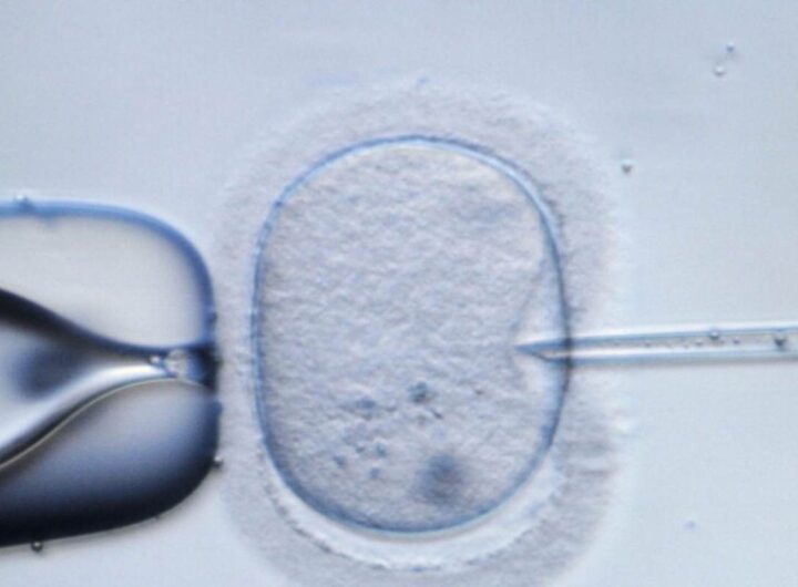 Rappresentazione della fecondazione in vitro