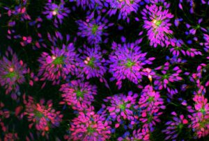 Cellule staminali senza il rischio di rigetto: balzo per la medicina rigenerativa